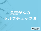 【食道がんセルフチェック】飲み込むときの”違和感”は要注意？なりやすい人も医師が解説！