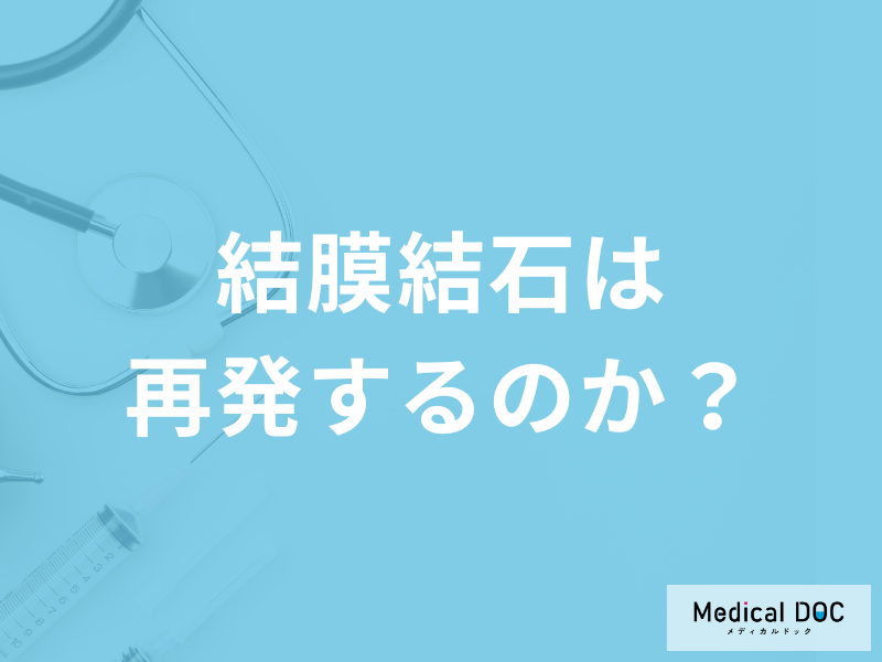 「結膜結石」はどのくらいの期間で治る？再発についても医師が解説！