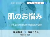 「肌トラブル」で悩む人は必見! シミ・肝斑・ほくろ・ニキビ跡ができたときの対処法を医師が解説!