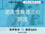 「逆流性食道炎の原因」はご存知ですか？発症しやすい人の特徴も解説！【医師監修】