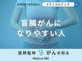 「盲腸がんになりやすい人」の特徴はご存知ですか？初期症状や好発年齢も医師が解説！