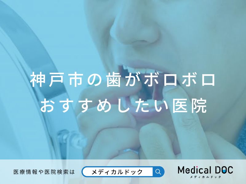 神戸市の歯がボロボロ おすすめしたい医院