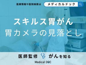 「スキルス胃がん」は胃カメラで「見落とされる」？信頼できる検査方法について医師が解説！