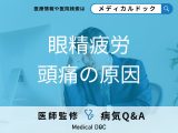 「眼精疲労で頭痛が起きやすい原因」とは？発症しやすい人の特徴も解説！【医師監修】