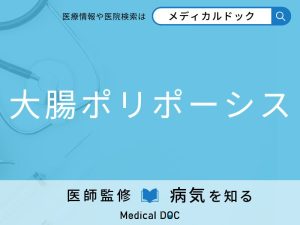 大腸ポリポーシス