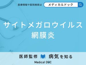 サイトメガロウイルス網膜炎