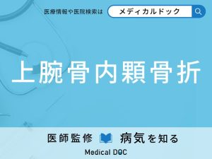 上腕骨内顆骨折