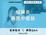 非公開: 「結膜炎」の原因や症状はご存知ですか？【医師監修】