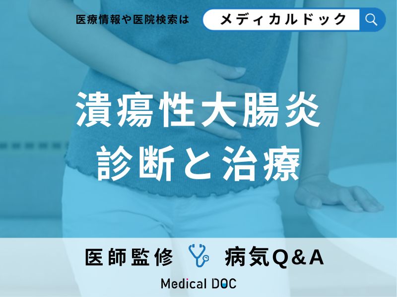 潰瘍性大腸炎の診断と治療