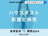 非公開: 「ハウスダスト」の影響を受けやすい人の特徴はご存知ですか？【医師監修】