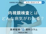 非公開: 胃がん・大腸がんを早期発見する方法とは? 内視鏡検査の進化と重要性について医師が解説