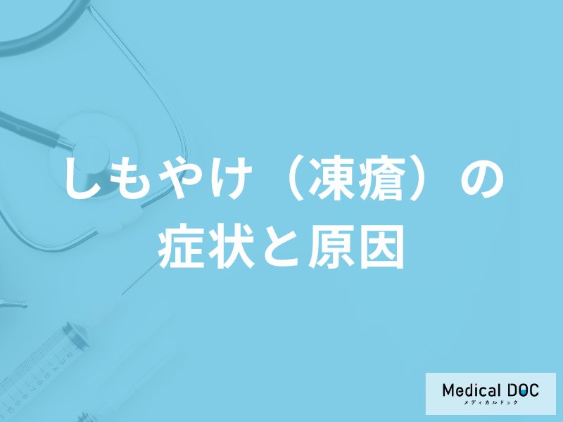 「しもやけ（凍瘡）」になりやすいのは体質？症状や原因も解説！【医師監修】