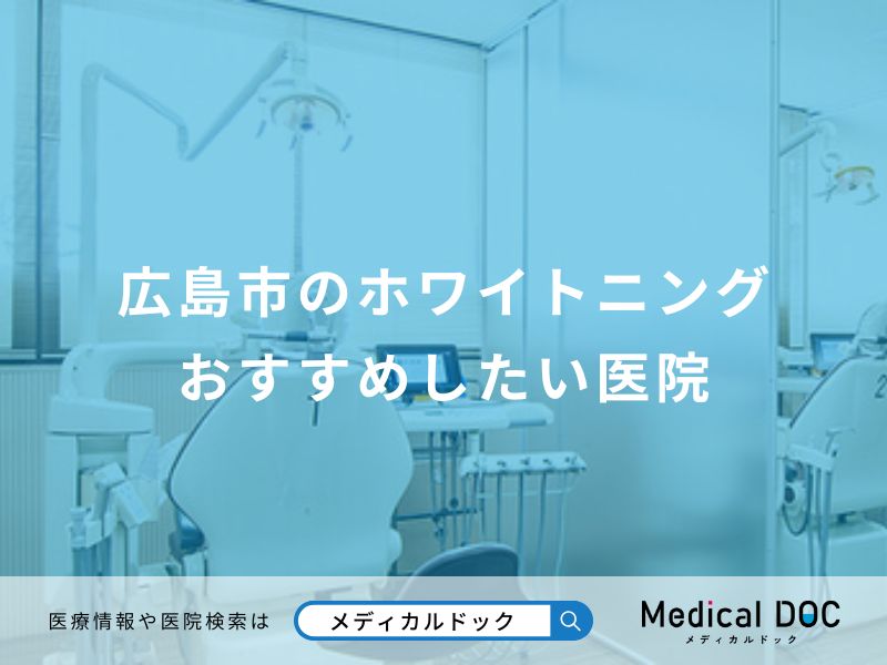 広島市のホワイトニング おすすめしたい医院