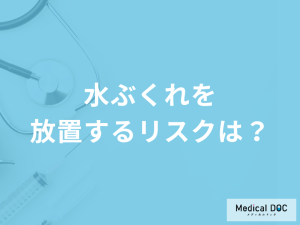 「水ぶくれを放置するリスク」は何かご存知ですか？注意点も医師が解説！