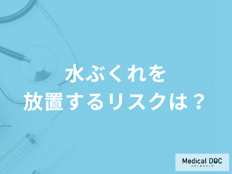 「水ぶくれを放置するリスク」は何かご存知ですか?注意点も医師が解説!