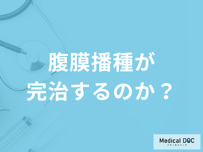 「腹膜播種は完治」する？完治が難しい理由と治療法を医師が解説！