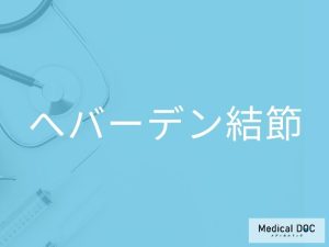 へバーデン結節