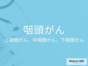 咽頭がん（上咽頭がん、中咽頭がん、下咽頭がん）