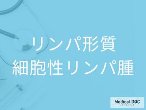 リンパ形質細胞性リンパ腫