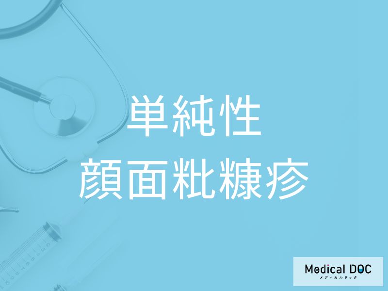 単純性顔面粃糠疹