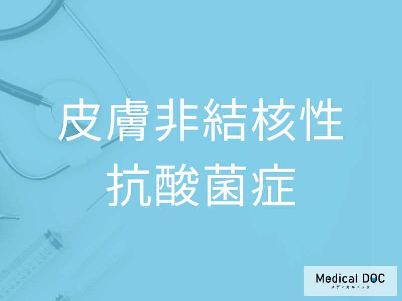 皮膚非結核性抗酸菌症