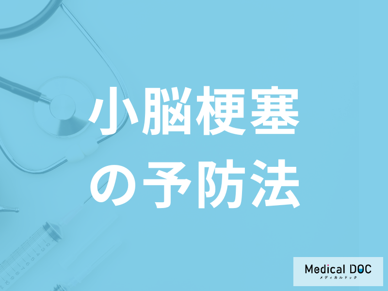 「小脳梗塞の予防法」は何を注意すれば良いのかご存知ですか？医師が徹底解説！