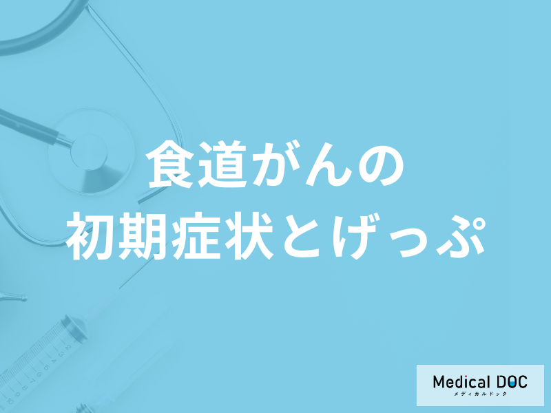 『げっぷが続く』のは「食道がんの初期症状」？進行すると現れる症状も医師が解説！