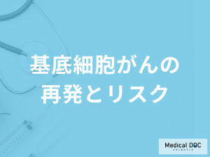 「基底細胞がんの放置するリスク」はご存知ですか？再発も医師が解説！