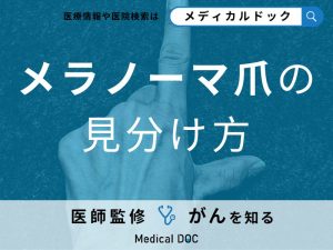 爪にできた「メラノーマの見分け方」はご存知ですか？【医師監修】