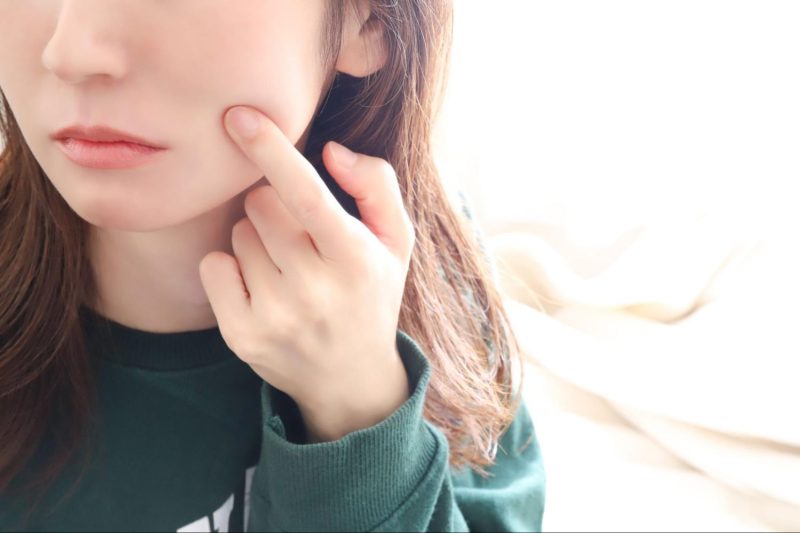 肌を気にする女性
