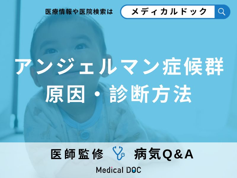 「アンジェルマン症候群」とは？症状・特徴・原因についても詳しく解説！