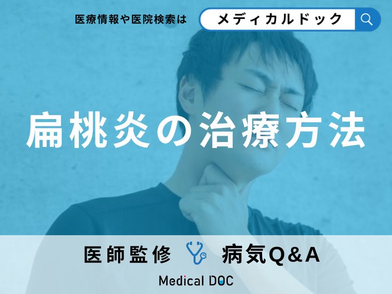 「扁桃炎」とは?症状・原因・治療法についても解説!【医師監修】