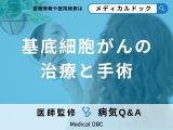 非公開: 「基底細胞がん（皮膚がんの一種）」の初期症状はご存知ですか？【医師監修】