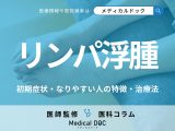 「リンパ浮腫」の初期症状はご存じですか? なりやすい人の特徴・4つの治療法も医師が解説!