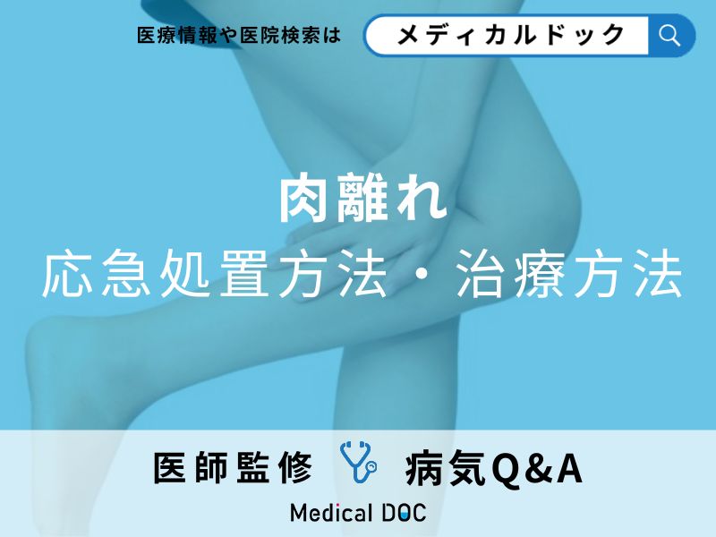 「肉離れ」の完治はどのくらいかかる?3つの応急処置も解説!【医師監修】