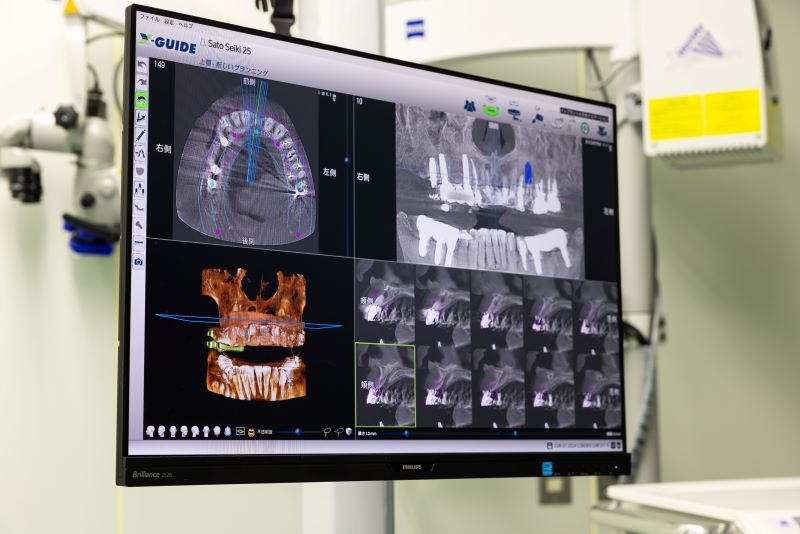マモインプラントクリニックマリオス