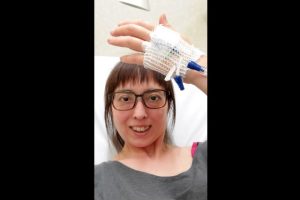 【闘病】｢皮膚筋炎｣で全身に激痛､"どす黒く腫れた足" ｢シェーグレン症候群｣も抱えながら…