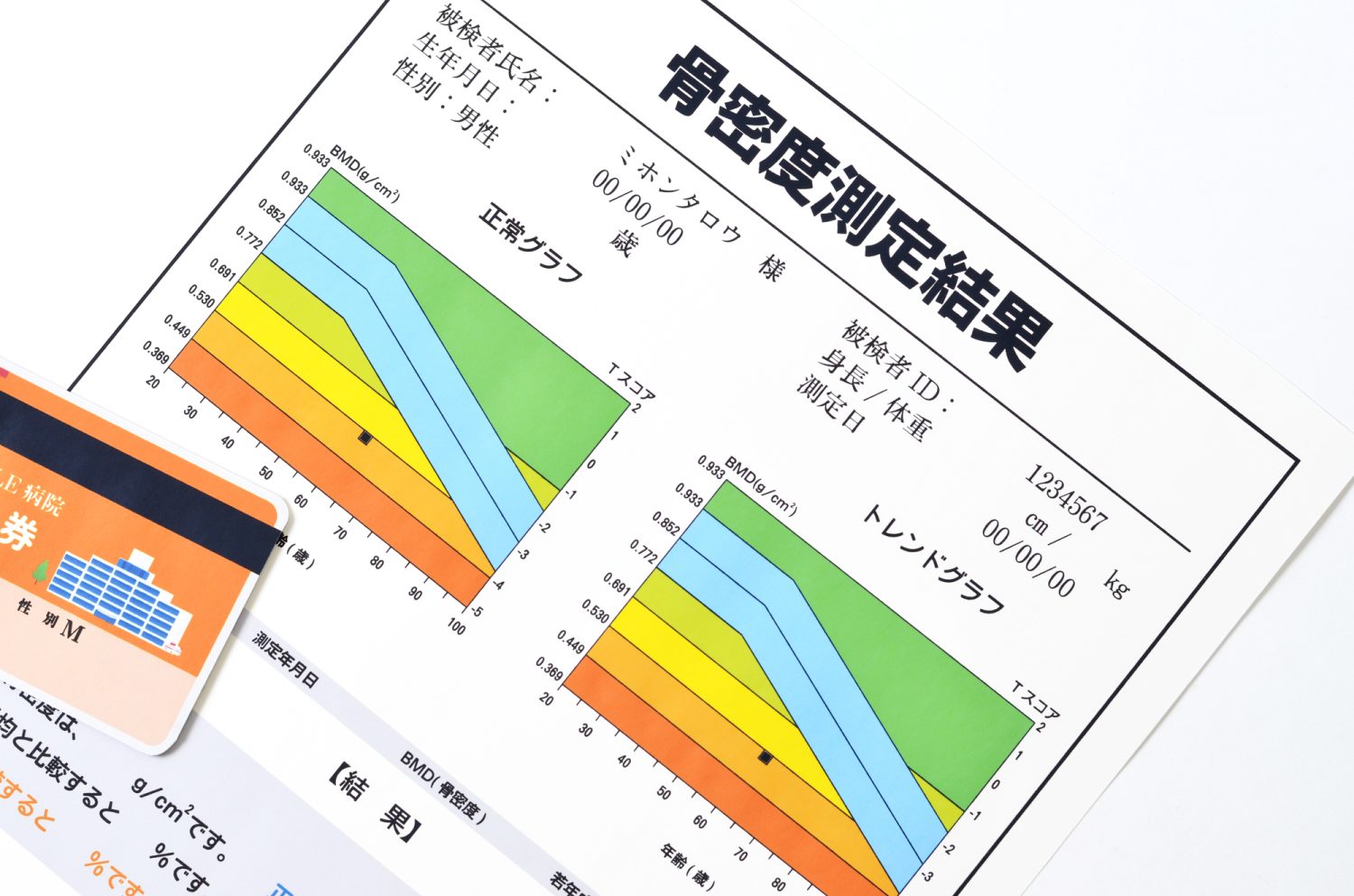 骨粗しょう症の検査と治療方法