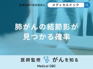 「肺がんの結節影」がレントゲンで見つかる確率はどれくらい？【医師解説】