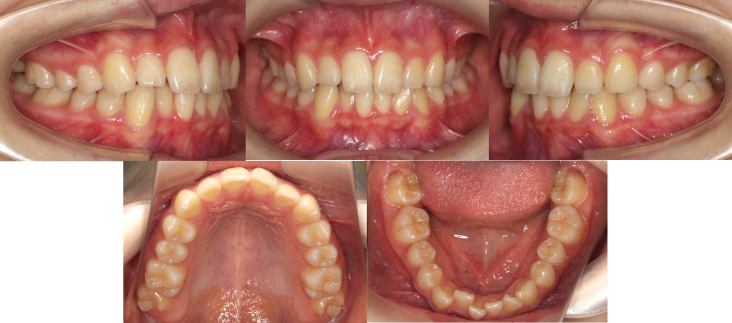 蒲田あさみ矯正歯科