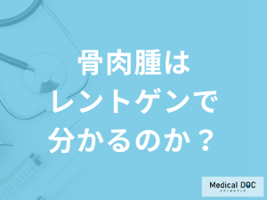 「骨肉腫を疑った場合レントゲン」でわかるのか？症状と検査法について医師が解説！