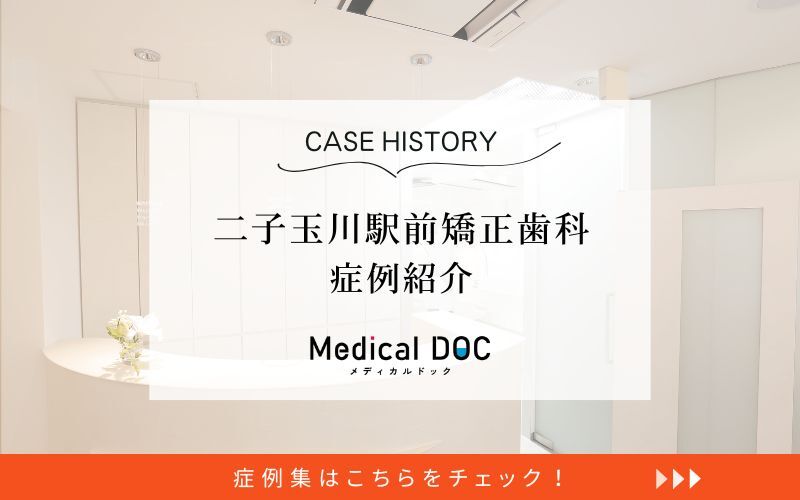 スマイル＋さくらい歯列矯正歯科二子玉川photo