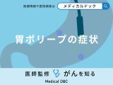 非公開: 「胃ポリープができると現れる症状」はご存知ですか？医師が解説！
