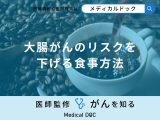非公開: 「大腸がんのリスクを下げる食事方法」はご存知ですか？【医師監修】