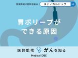非公開: 「胃ポリープができる原因」はご存知ですか？医師が解説！