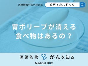 「胃のポリープが消える食べ物」はあるの？胃ポリープができやすい人の食生活も解説！