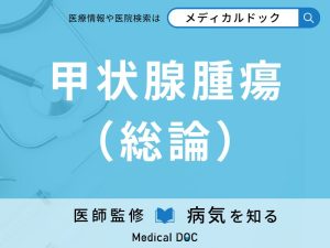 甲状腺腫瘍（総論）