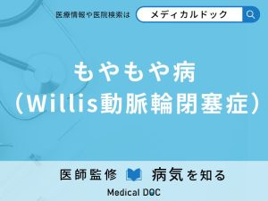 もやもや病（Willis動脈輪閉塞症）