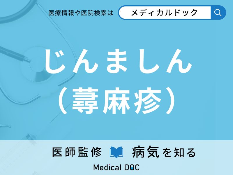 じんましん（蕁麻疹）