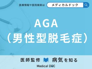 AGA（男性型脱毛症）